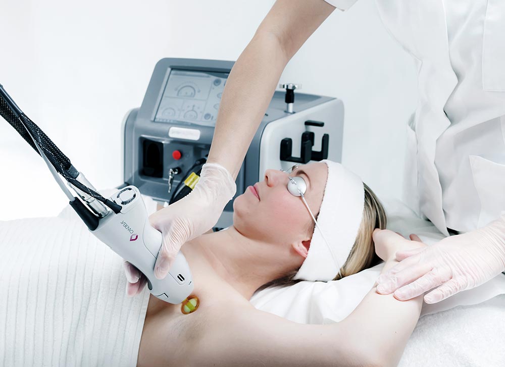 laser hair removal treatment