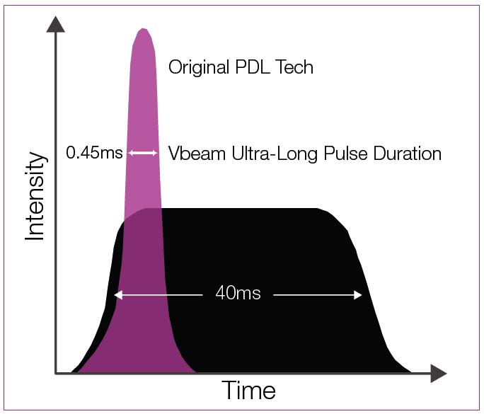 Vbeam ultra-long pulse duration