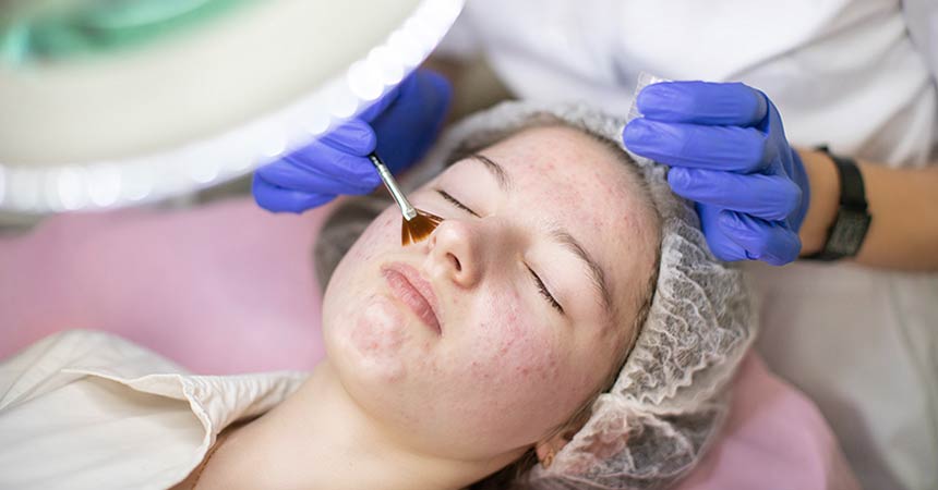 attract new patients with acne treatment