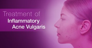 Treatment of inflammatory acne vulgaris